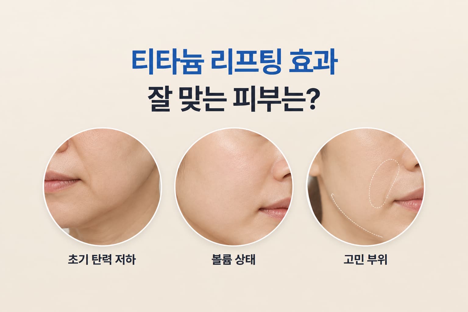 티타늄 리프팅 효과는 어떤 피부에 잘 나타날까_얼굴형·부위별 판단 기준
